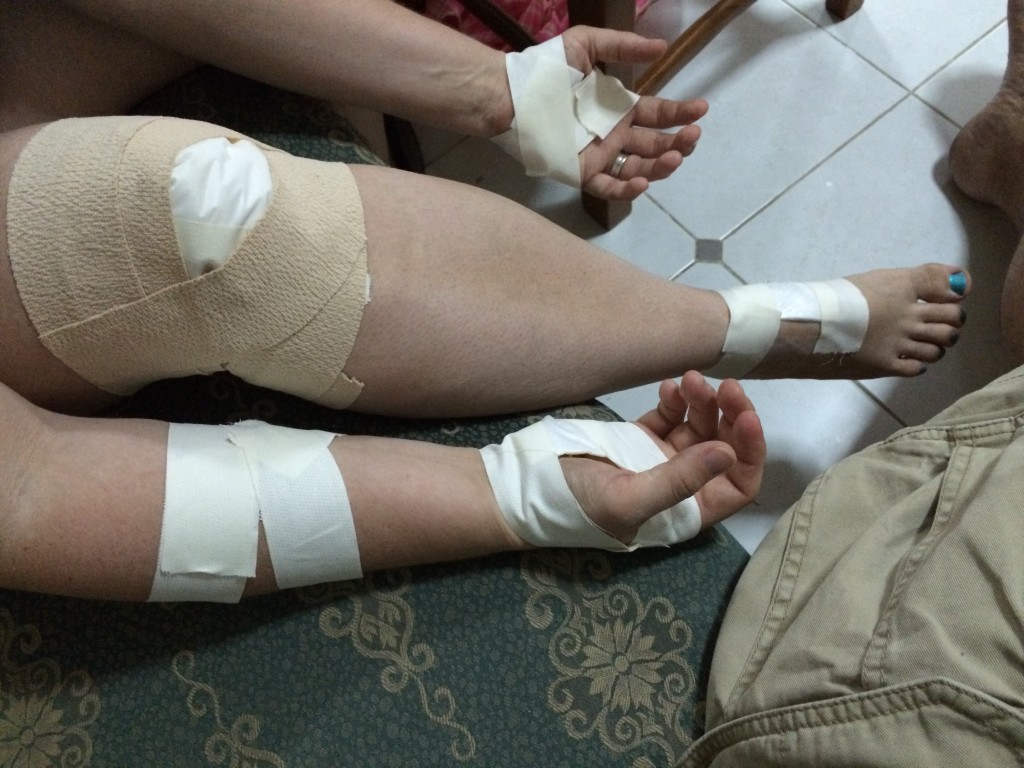 All Bandaged Up: both hands, right forearm, right knee and right foot.